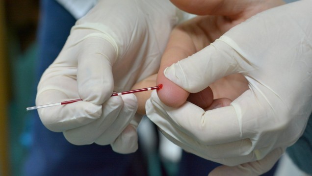 imagen Realizarán testeos de VIH y Hepatitis a estudiantes de Odontología y Medicina